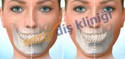 Sezgi Diş | Diş Hekimi | Diş Doktoru | İmplant 